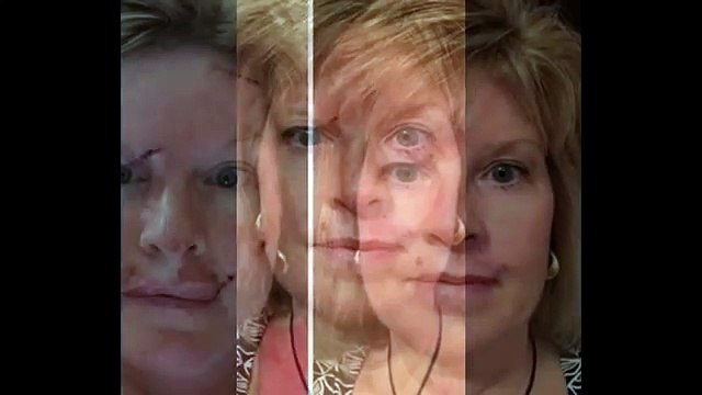 Guardate cosa è capitato a questa donna... Fate attenzione!