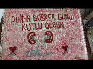 diyaliz pasta ksim töreni hazır