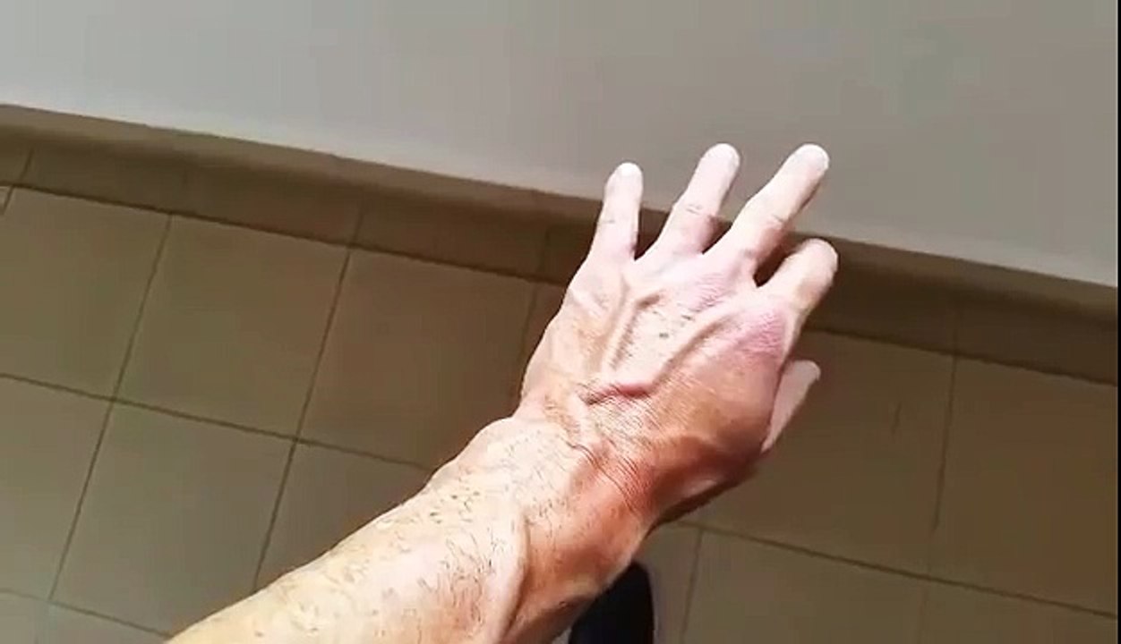 Man Plays with Dancing Vein