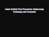 [Download] Lower Genital Tract Precancer: Colposcopy Pathology and Treatment [Read] Online