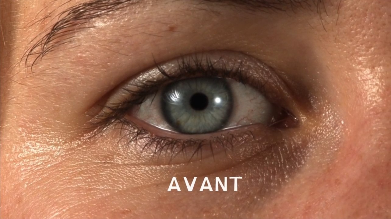 Oeil after effect