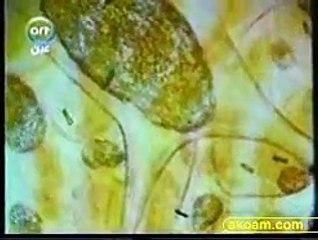 العلم و الايمان   113-  الفيروسات