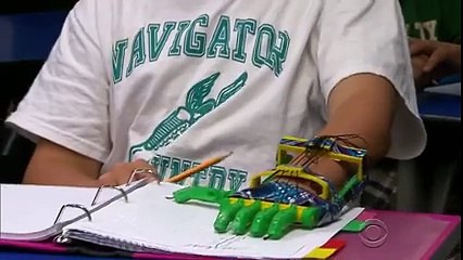 Augmented Humans_ Technology is Changing Lives