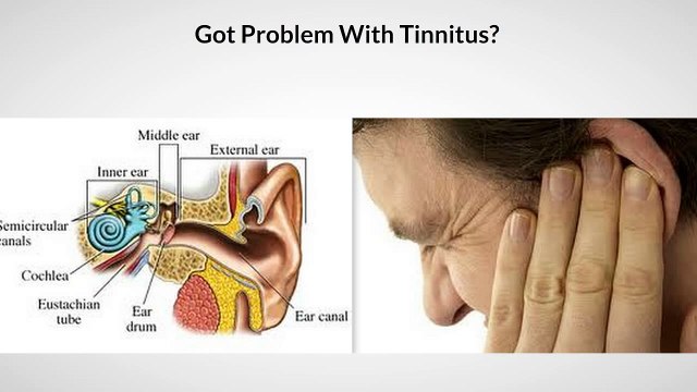 Tinnitus Sound - Acupuncture And Tinnitus