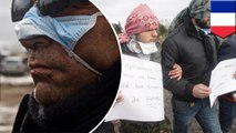 Imigran menjahit mulut dalam aksi protes di Calais Perancis