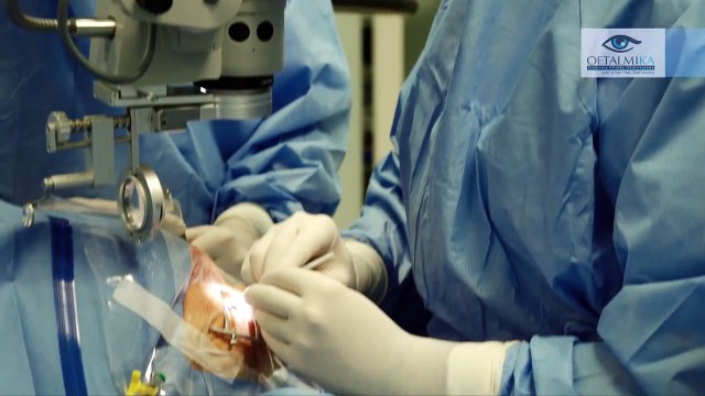 Witrektomia. Sprzęt stosowany podczas operacji - oftalmika.pl