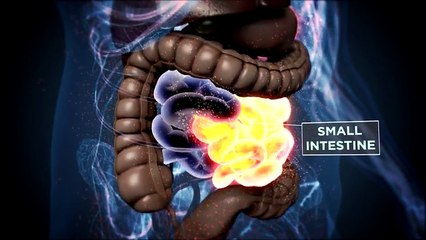 What exactly is happening in the body during a hangover? And what makes them worse? Michael Mosley explains.