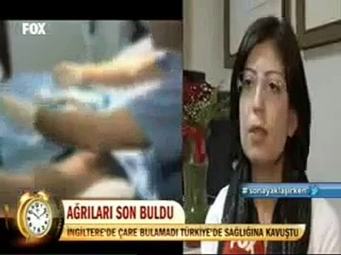 Varis Ameliyatı Tedavisi Varis Nasıl Tedavi Edilir Ve Geçer Varise Kesin Çözüm