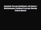 Read ‪Zapalenie Tarczycy Hashimoto: Jak Znalezc i Wyeliminowac Zrodlowa Przyczyne Choroby (Polish‬