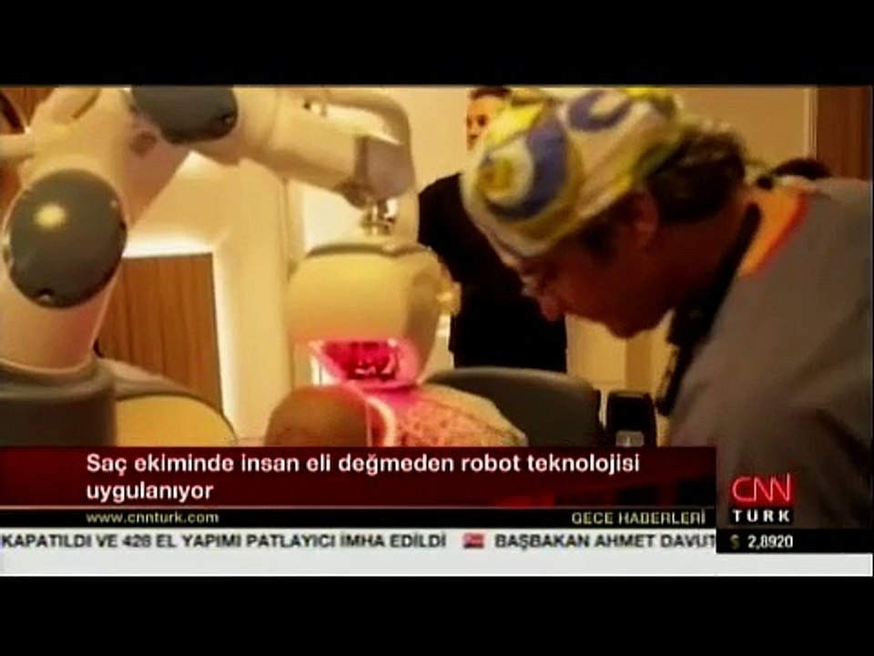 Esteworld Saç Ekimi Robotu - CNNTürk Haber