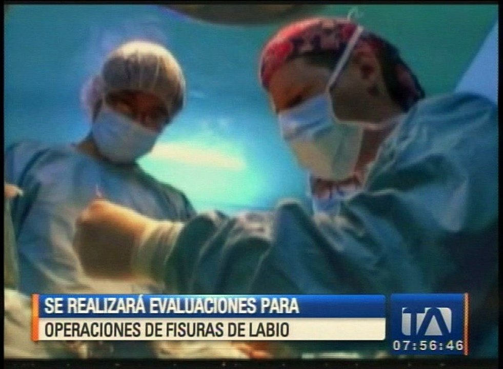 Realizarán evaluaciones para operaciones gratuitas de fisuras de labio y paladar