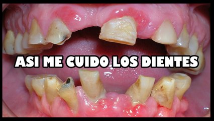 ASI ME CUIDO LOS DIENTES ODONTOLOGIA MODERNA VIDEOS DE RISA