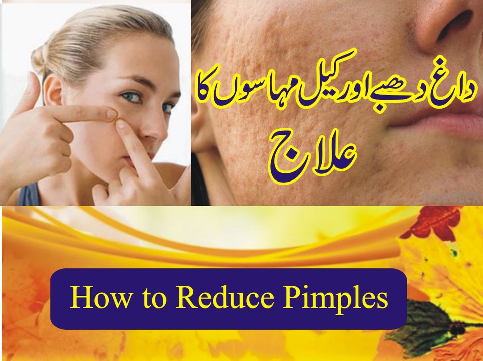 How to remove acne or pimple mark I چہرے سے دانے اور داغ ختم کرنا I How to Get Rid of Pimples and Pimple Marks Fast I Best home remedies to remove pimple marks