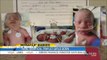 Two Bodies Three Babies: Incredibly Rare Identical Triplets Born In Texas With Two Joined(