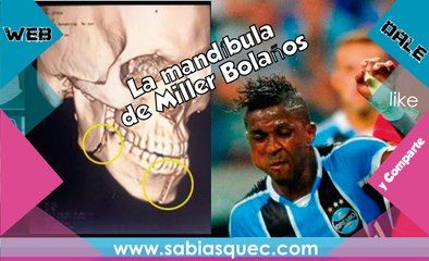 La mandíbula del delantero tricolor Miller Bolaños fue reconstruida / SBQ WEB