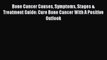 Download Bone Cancer Causes Symptoms Stages & Treatment Guide: Cure Bone Cancer With A Positive