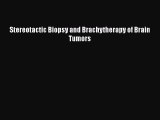 Read Stereotactic Biopsy and Brachytherapy of Brain Tumors Ebook Online