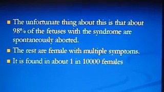turner's syndrome
