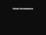 Read Colonic Carcinogenesis Ebook Free