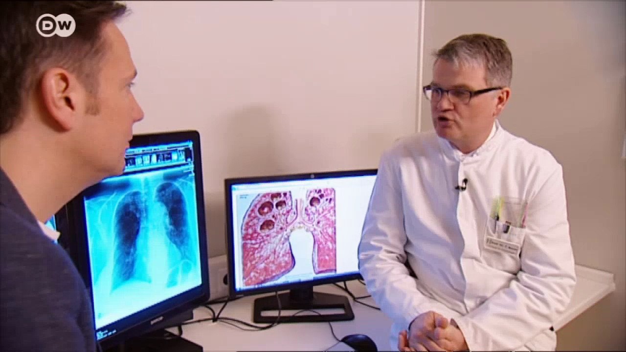 Tuberkulose bekämpfen | Fit & gesund