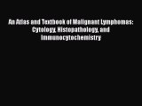 Download An Atlas and Textbook of Malignant Lymphomas: Cytology Histopathology and Immunocytochemistry