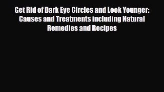 Read ‪Get Rid of Dark Eye Circles and Look Younger: Causes and Treatments including Natural