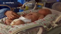 Baby born with heart on the outside of his body