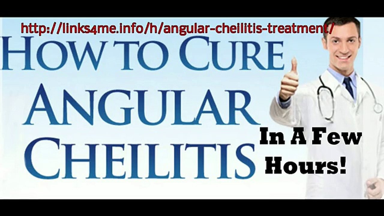 Best Home Angular Cheilitis Treatment Works Fast