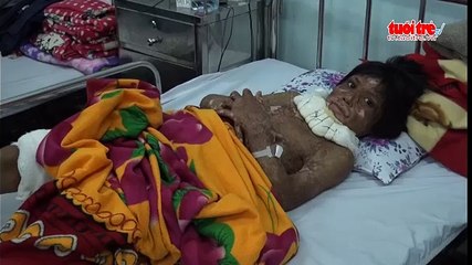 Phẫu thuật miễn phí cho 68 bệnh nhân nghèo bị dị tật