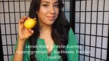 Using Lemon to Treat Acne Scars, Acne, Uneven Skin, Blackheads, Age Spots, Freckles & MORE