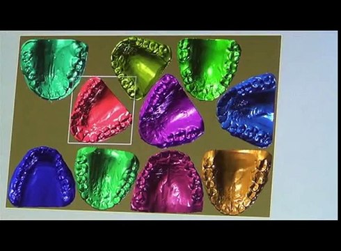 Il fabrique un appareil dentaire qui ne lui coûte presque rien grâce à une imprimante 3D