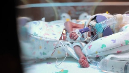 Baby Was Born 3.5 Months Early. What His Dad Does Is Extraordinary…