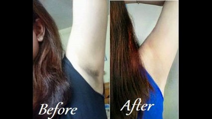 How to get Smooth Fairer Underarms Instantly