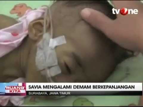 Savia Naila Putri, Bayi Penderita Kelainan Hati