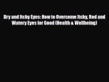 Read ‪Dry and Itchy Eyes: How to Overcome Itchy Red and Watery Eyes for Good (Health & Wellbeing)‬