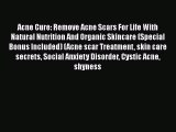 Read Acne Cure: Remove Acne Scars For Life With Natural Nutrition And Organic Skincare (Special