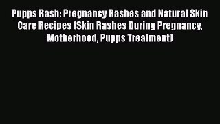 Download Pupps Rash: Pregnancy Rashes and Natural Skin Care Recipes (Skin Rashes During Pregnancy