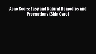 Read Acne Scars: Easy and Natural Remedies and Precautions (Skin Care) Ebook Free