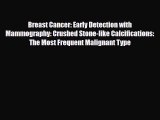 Read ‪Breast Cancer: Early Detection with Mammography: Crushed Stone-like Calcifications: The