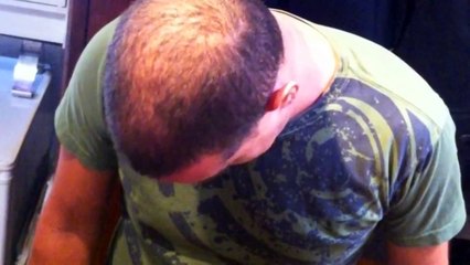Minoxidil (Rogaine) A Quick How to Guide with Before & After results