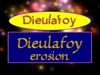 French name pronunciation