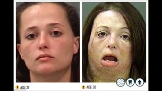 Horror Of Meth: Shocking Before and after pictures Of Meth Addicts