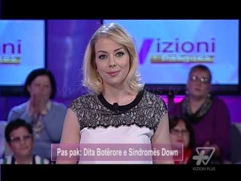Vizioni i pasdites - Dita Botërore e Sindromës Down - 21 Mars 2016 - Show - Vizion Plus