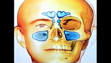 3.   ACCIDENT 1973  ( Au Carrefour de Ma Vie )