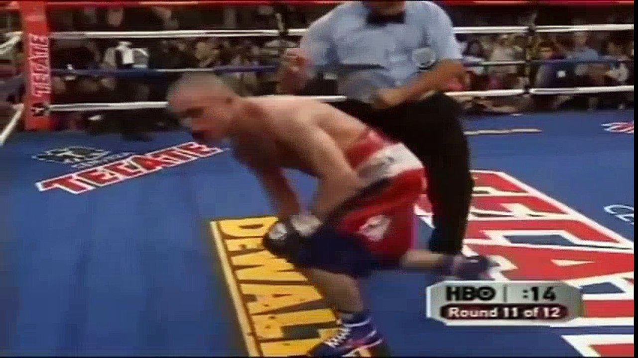 Top 15 worst boxing injuries  Best Boxers Ever