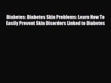 Download ‪Diabetes: Diabetes Skin Problems: Learn How To Easily Prevent Skin Disorders Linked