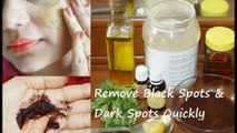 How to Remove Black Spots & Dark Spots on Face (Get Flawless Face in 10 Days)