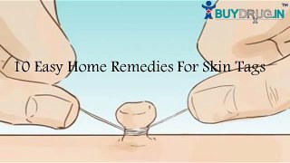 10 Home Remedies For Skin Tags