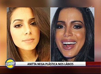 ANITTA NEGA PLÁSTICA NOS LÁBIOS