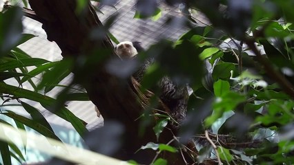 This Is What It Means When Your Tendon Protrudes Out Of Your Wrist